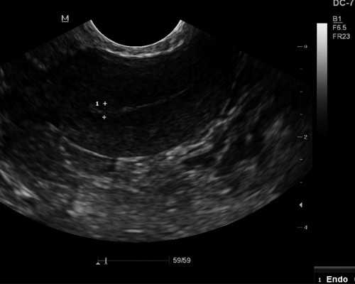 天津供卵助孕妈妈分享：我的儿子是怎么诞生的，备孕与生产过程全记录