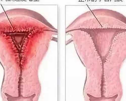 哪个医院能供卵_国内有供卵试管吗,2024江西省妇幼保健院做一次供卵三代试管费